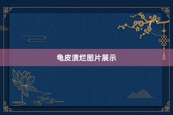 龟皮溃烂图片展示